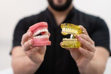 İnvisalign ve Geleneksel Diş Telleri Arasındaki Farklar