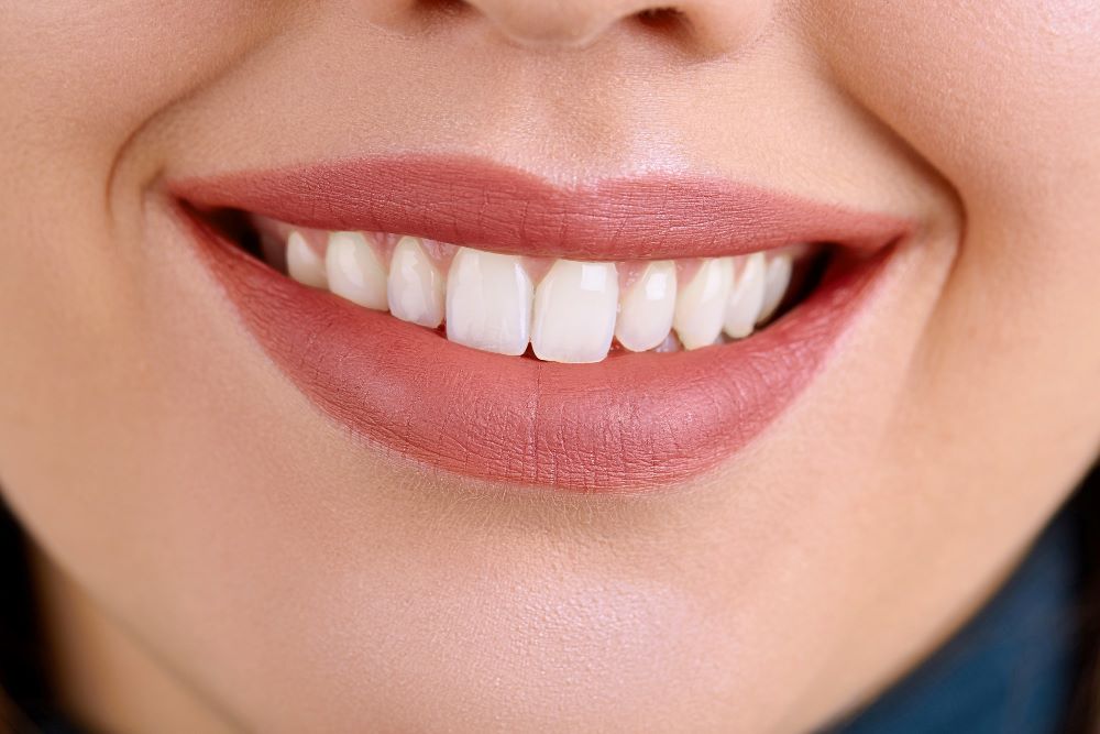 Hollywood Smile (Hollywood Gülüşü) Nedir?